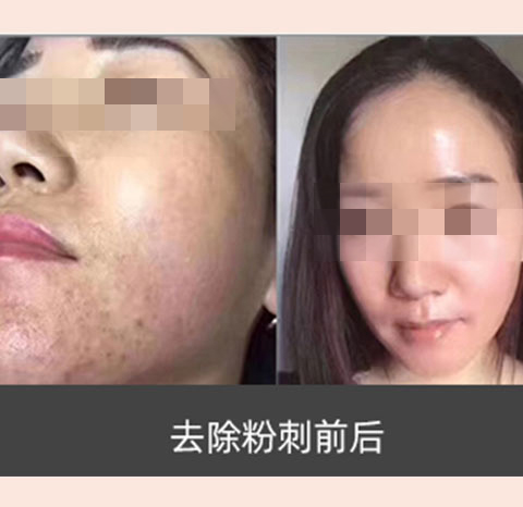 素颜肌肤_养_护_修