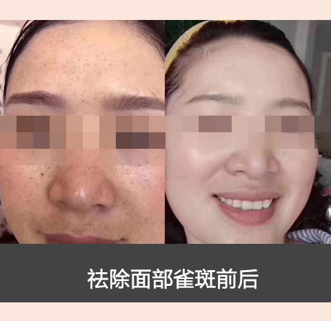 素颜肌肤_养_护_修